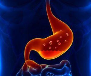 Что делать с запорами при гастрите