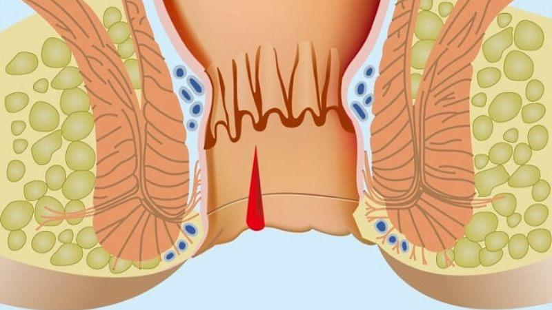 почему постоянно чешется анус