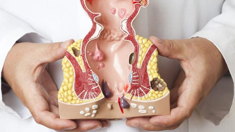 жжение после дефекации в заднем проходе